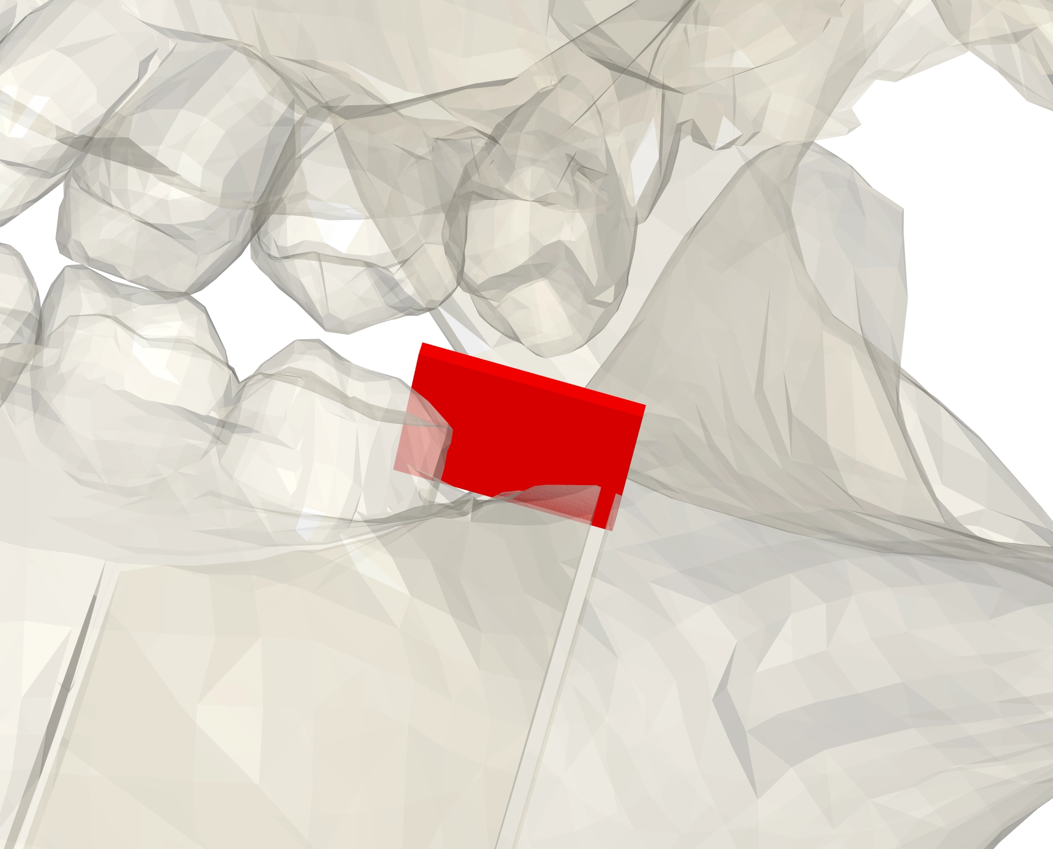 The image shows a transparent skull model with a cuboid cutting tool mimicking the cut performed by a surgeon to allow for realignment.