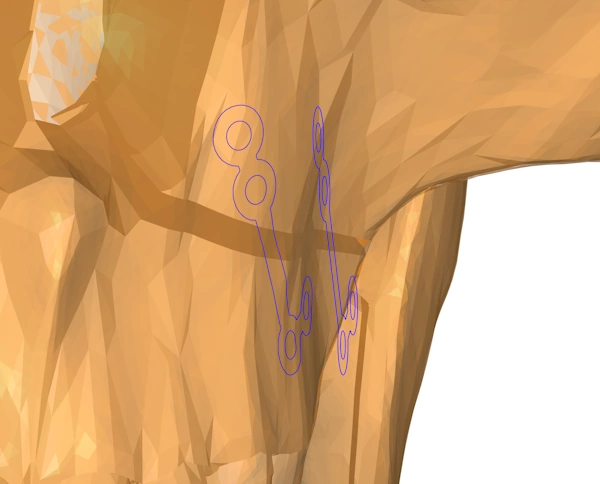 A 2D planar slice through a strip implant placed above the skull model, and also wrapped onto the skull model using a uv wrapping.