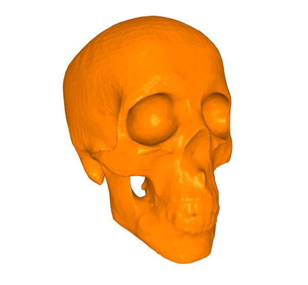 A shrinkwrapped mesh of a skull model created from the skll model after the surgeon has performed cuts and jaw realignmment. The shrinkwrap has smoothly covered over the gaps.
