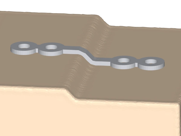 The strip plate has been bent so it conforms to the kind in the surface