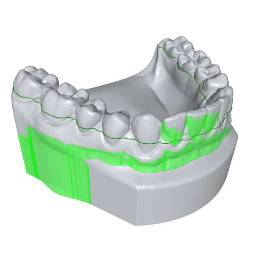 The image shows a lower jaw with swept geometry to remove undercuts.