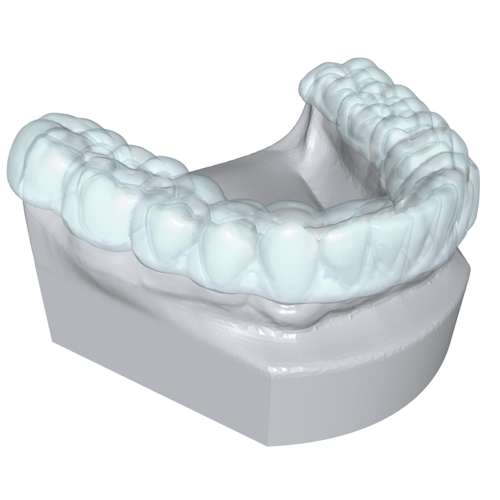 A lower jaw with an aligner created across the whole range of teeth.