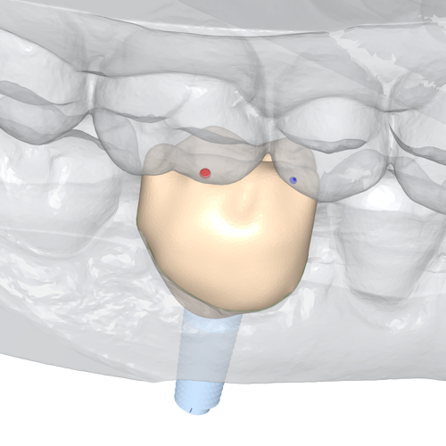 Using guide points the occluded areas are adjusted so the occlusion is removed.