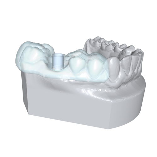 A lower jaw model with a transparent implant guide covering a portion