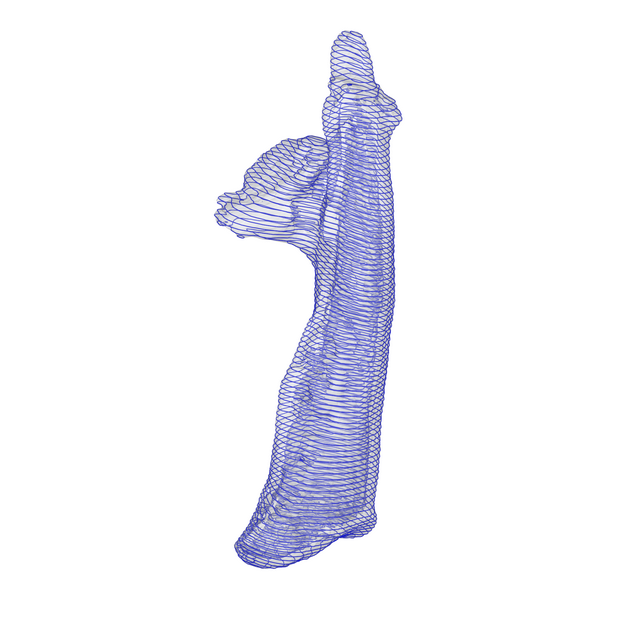 A transparent image of a bone model showing internal thickness with one hundred planar slices