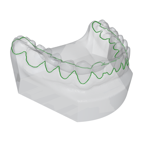 A lower jaw model with a curve highlighting the gum / margin line. There are some regions where the curve is incorrect.