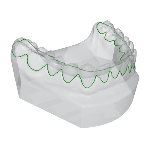 A lower jaw model with a curve highlighting the gum / margin line. The curve has been manually corrected.