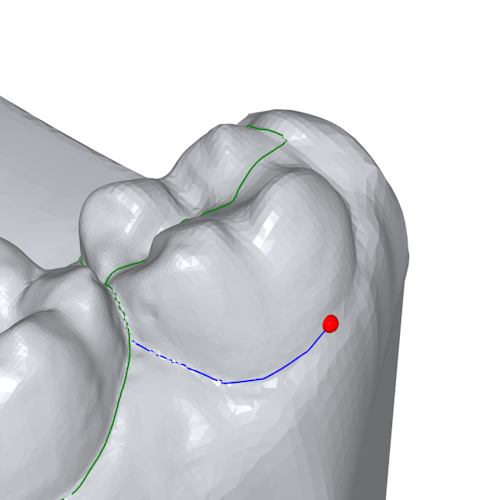 The image shows a tooth with the margin line being manually edited.