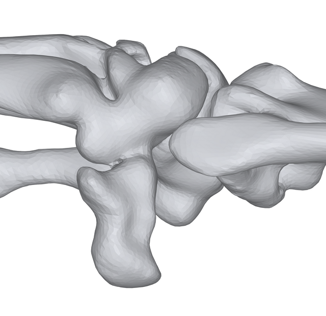 An image of a complex joint between two mesh models of bones.