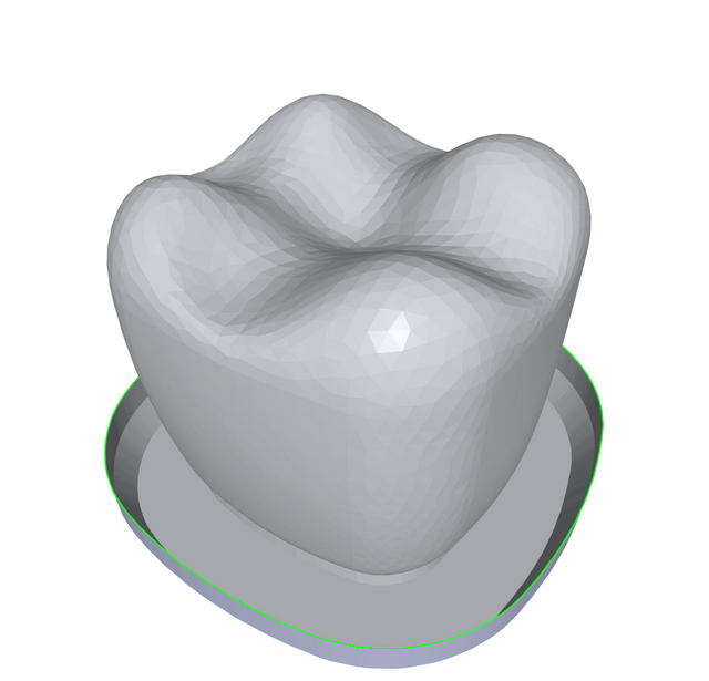 The open boundary has been extended in a series of steps to create a concave flap or skirt around the base of the model.